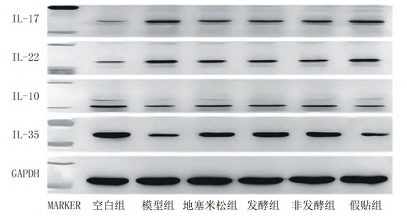 空白組和支氣管哮喘各組大鼠肺組織中IL－17、IL－22、IL－10、IL－35蛋白表達電泳圖
